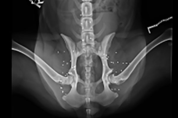 Golddraht-Akupunktur